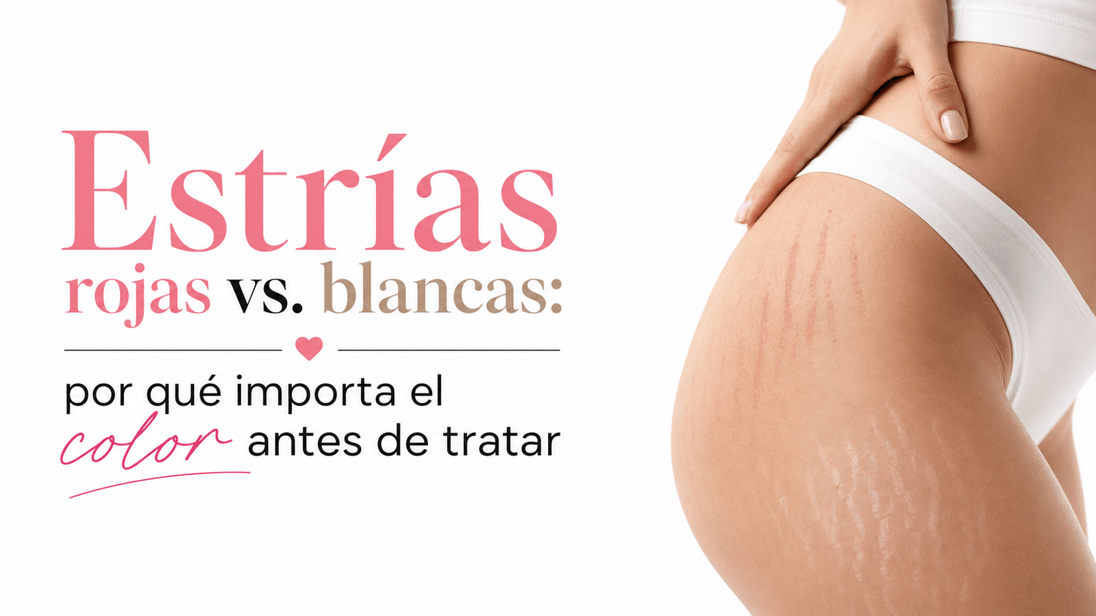 Estrías y tratamiento de la piel